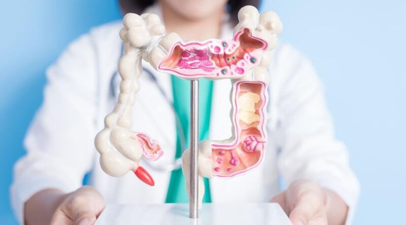 Cara Mudah Mengurangi Risiko Kanker Kolorektal